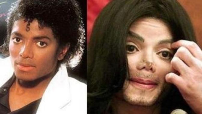 Is Michael Jackson considered black or white (after vitiligo)?