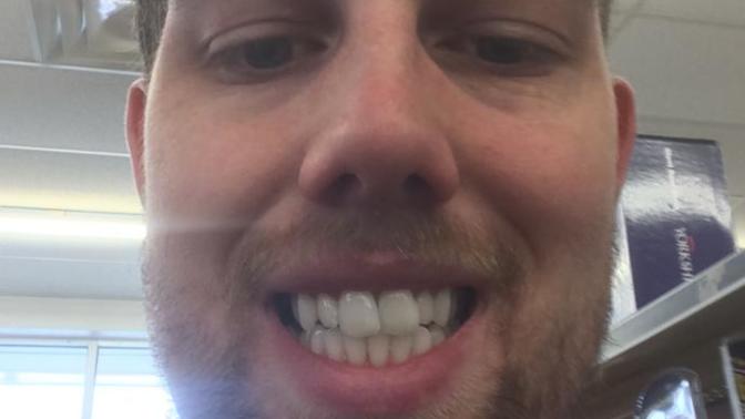 Would my teeth be unattractive and crooked for women? Is there anyway to straighten then up? Should I get braces at this point in my life?