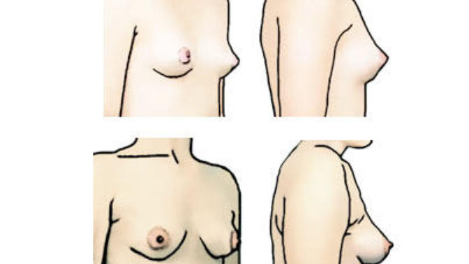 Are small pointy boobs unattractive?
