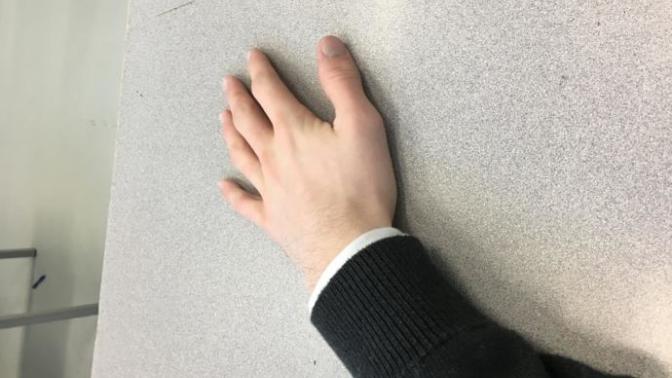My hand really really hurts rn and I'm stuck in school for like 5 more hrs. Got any advice for now?