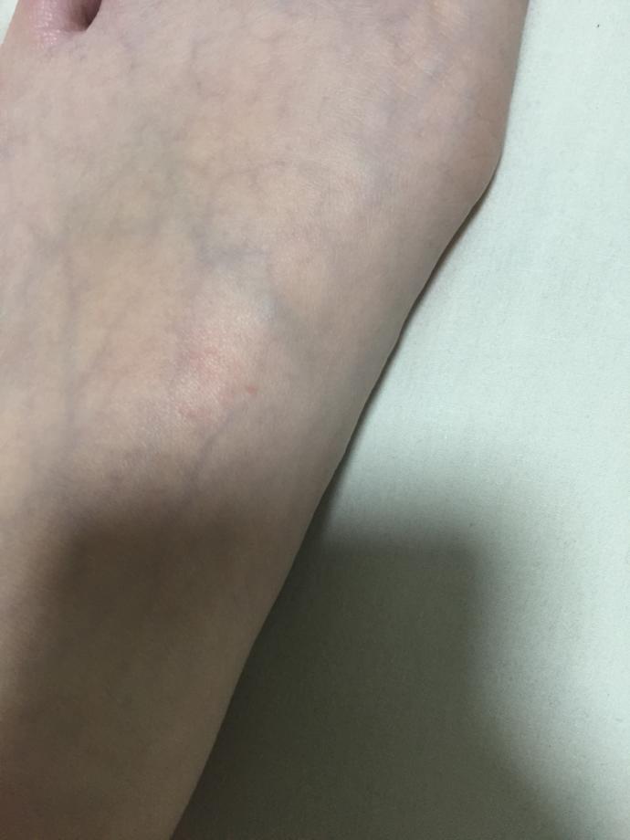 Why is my feet so veiny?