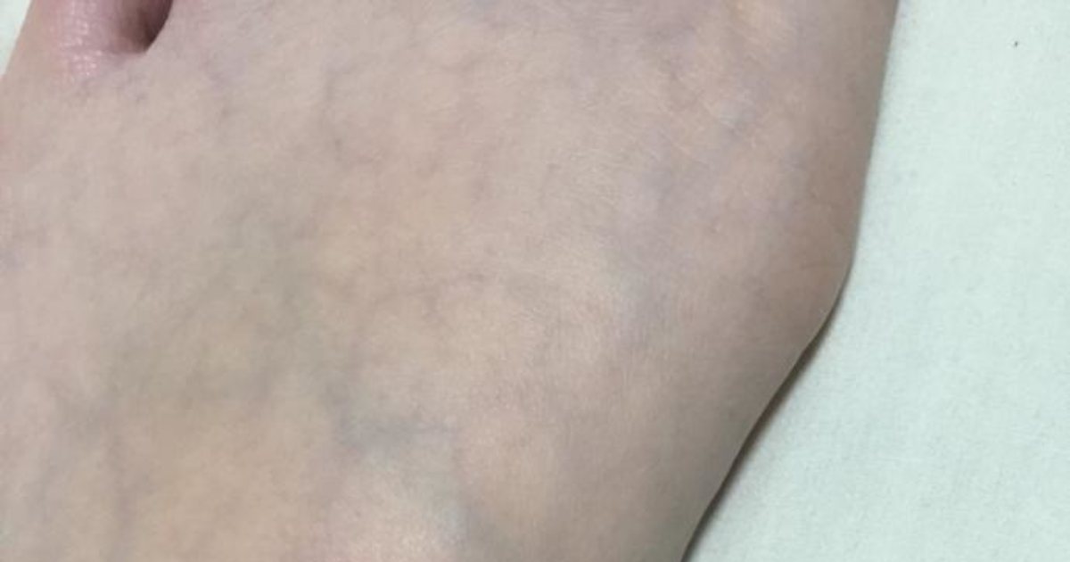 Why is my feet so veiny? GirlsAskGuys