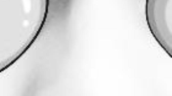 Is my nose really that insanely big? Should I get a nose job?