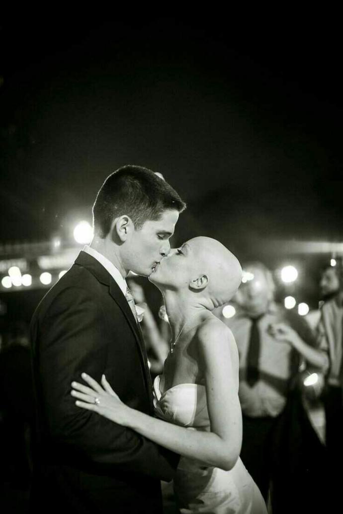Would you date a boy/girl who has alopecia (disease which cause hair loss)??
