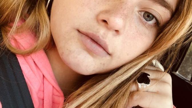Should I get lip fillers?