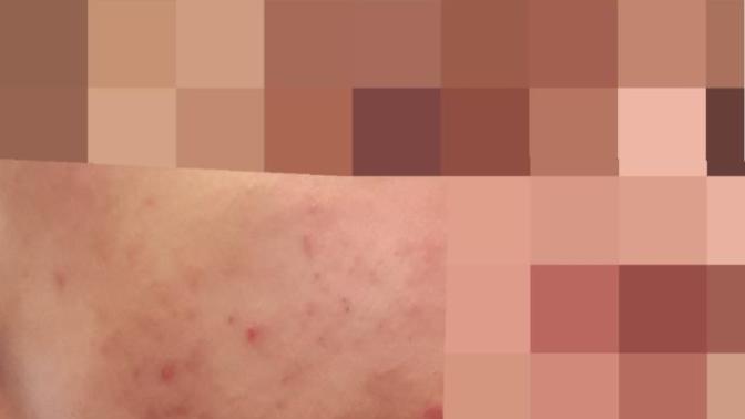 HOW CAN I GET RID OF THIS (PLEASE HELP) (PHOTO)?