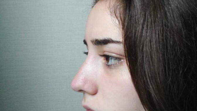 Could I get your opinion on my nose?