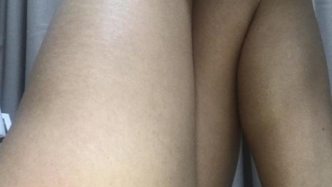 Are my stretch marks a turn off? Please be very honest?