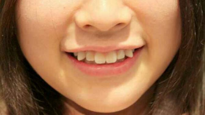 Do you think the Japanese "Yaeba" or "Snaggle Tooth" is cute or attractive?