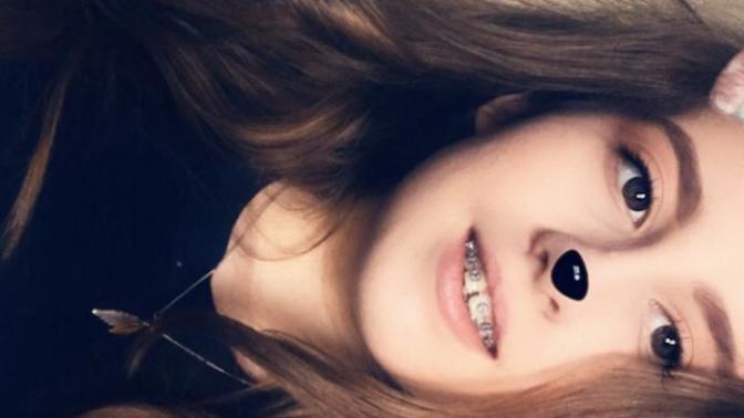 Do I suit braces?