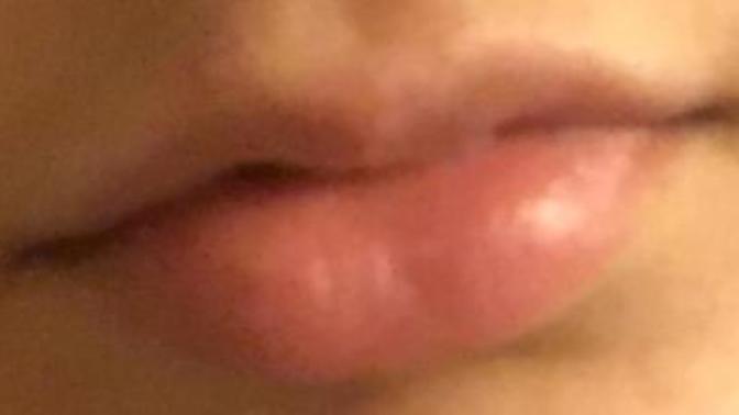 I HATE my top lip with a passion. Are there ways to make it look bigger?