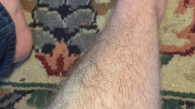 Are my legs hairy lol?