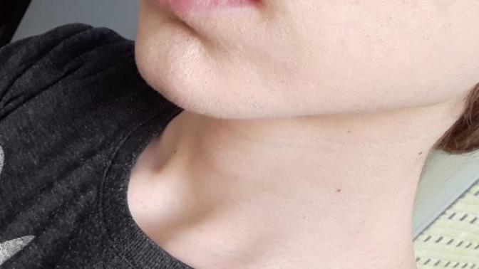 What is my skintone?