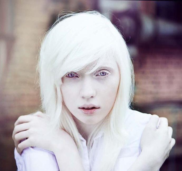 Would you ever date a albino person? 