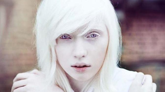 Would you ever date a albino person?