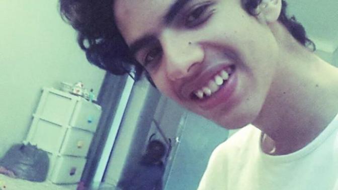 Self-consciousness about teeth?