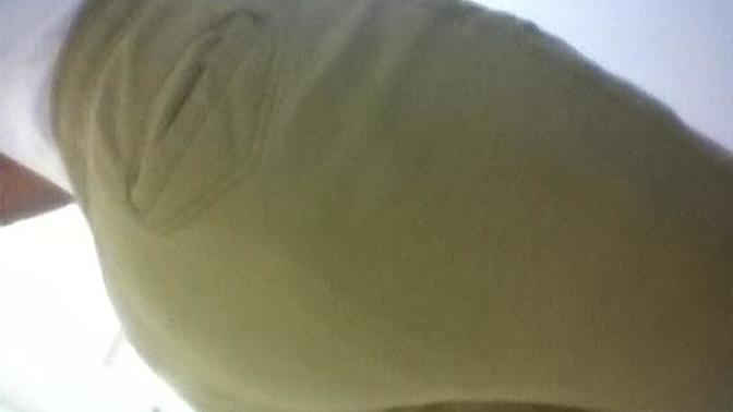 Is this normal for me to have this (picture included)?