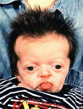 If you found out your child was special needs and look like This on night upon receiving child,would you or would you not keep the child??
