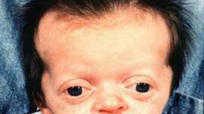 If you found out your child was special needs and look like This on night upon receiving child, would you or would you not keep the child?