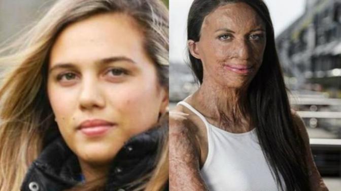 I would kill myself if I ever got horribly disfigured in an accident, isn't that logical?