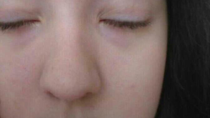 Is my nose too big?