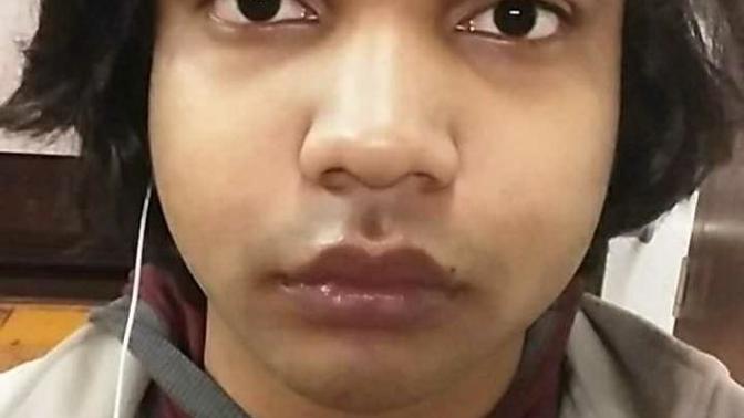 Do my chubby cheeks look bad on me? If so what can I do to reduce them? (Im already in a diet)?
