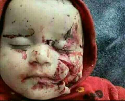 What are your thoughts on the ongoing chaos in Syria??