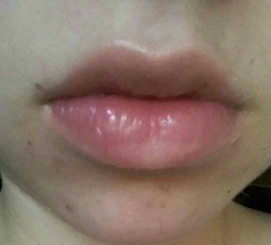 Are my lips too big??