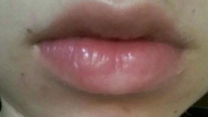 Are my lips too big?