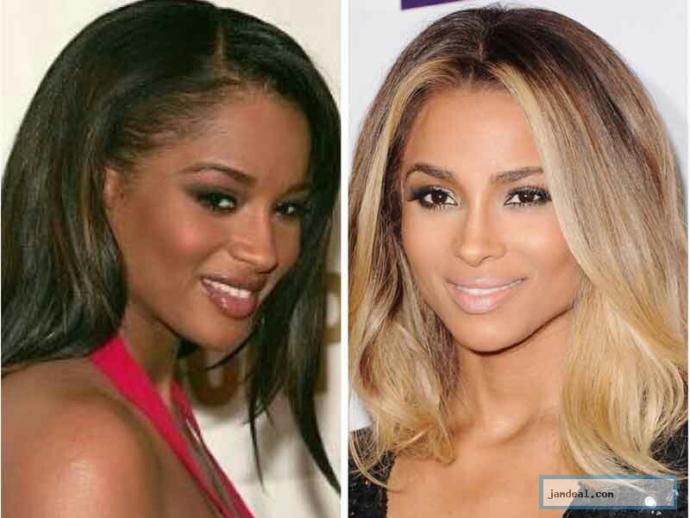 Skin bleaching vs tanning. Why the double standard??