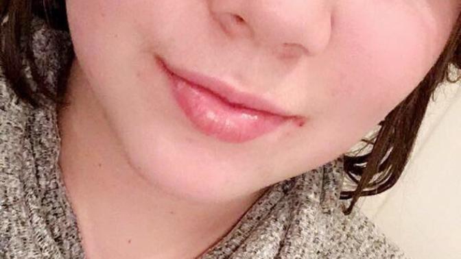 Do I have chubby cheeks?