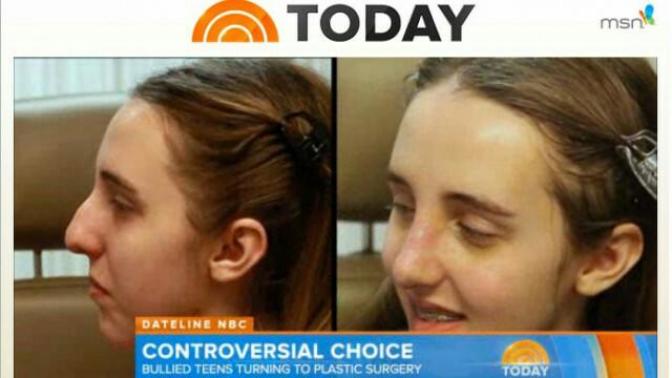 Plastic surgery: are we falling into society's pressure?