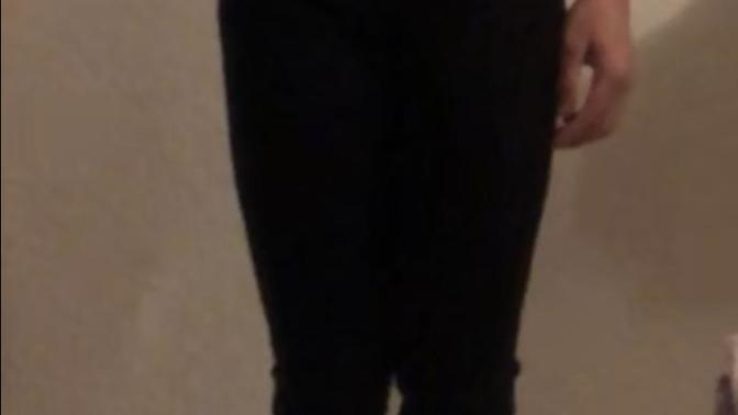 Do I have an ugly body for a 20 yr old female?