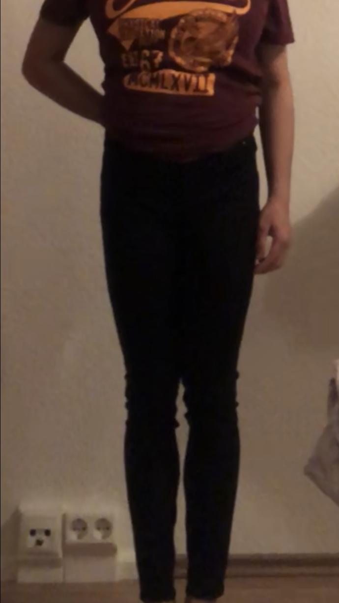 Do I have an ugly body for a 20 year old female?