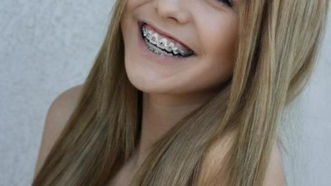 Would You Date a Girl With Braces?
