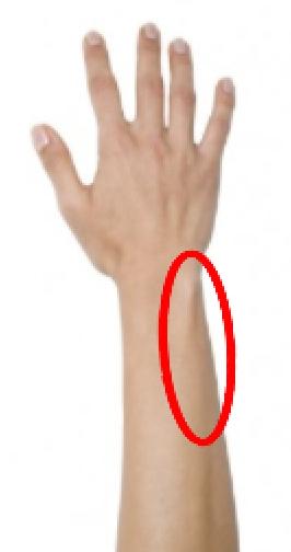 Is This Considered Self-Harm?