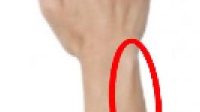 Is This Considered Self-Harm?