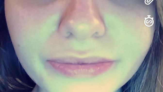 (pic) How can I fix my eye lid?