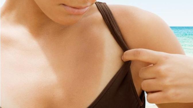 Are tan lines on a girl unattractive?