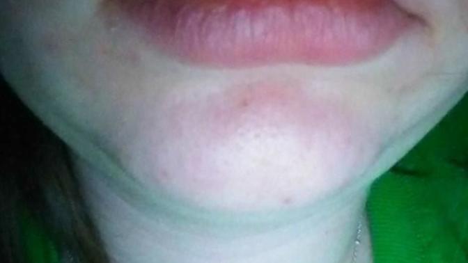 How do I stop biting my lips?