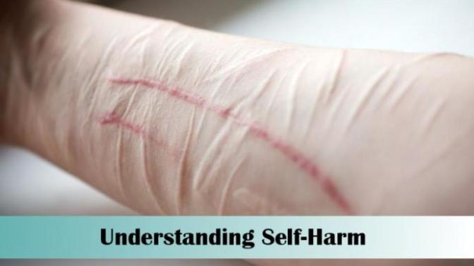 What would you do if a girl sent you a picture of her cut wrist bleeding?