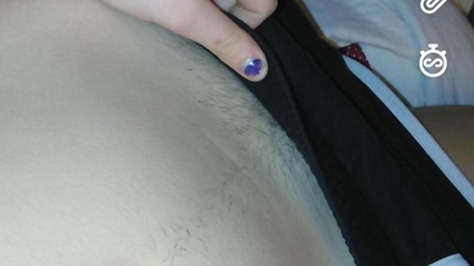 Happy trail. Do any other girls have this problem? (Pic)?