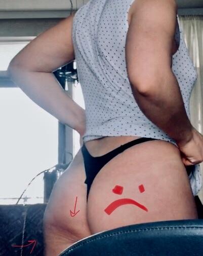 Guys, What’s this on my left buttcheek though ?sorry (last question)?