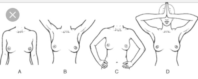 If i have breasts like the first picture can i use a push up to get the same look as the girl in the 2nd picture?