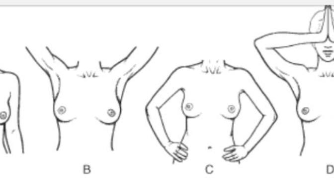 If I have breasts like the first picture can I use a push up to get the same look as the girl in the 2nd picture?