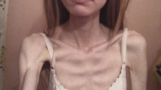 Does my sister really look weak? How do I convince her to gain weight?