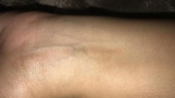 What’s my skin under tone?