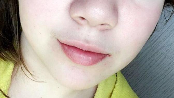 How are my natural features?