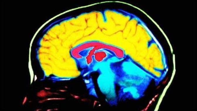 What do you think of this video? about the difference in the brains of Liberals and conservatives?