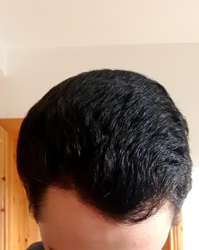 Am I going BALD in your opinion?